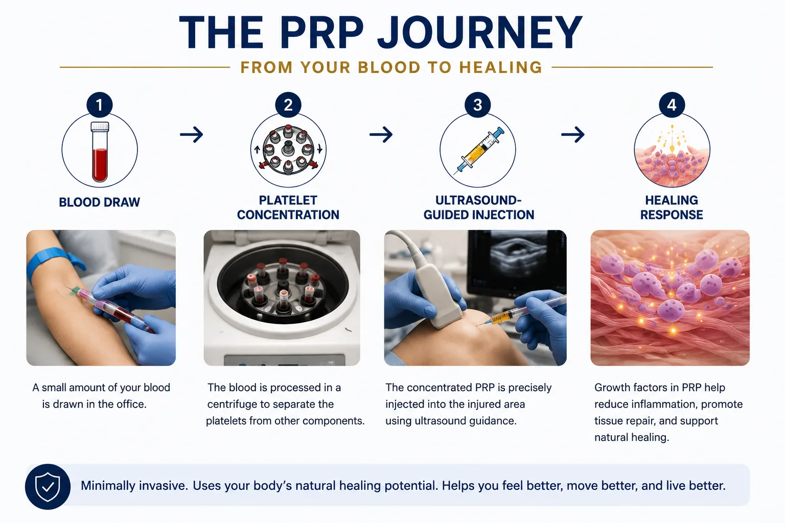 PRP treatment journey infographic