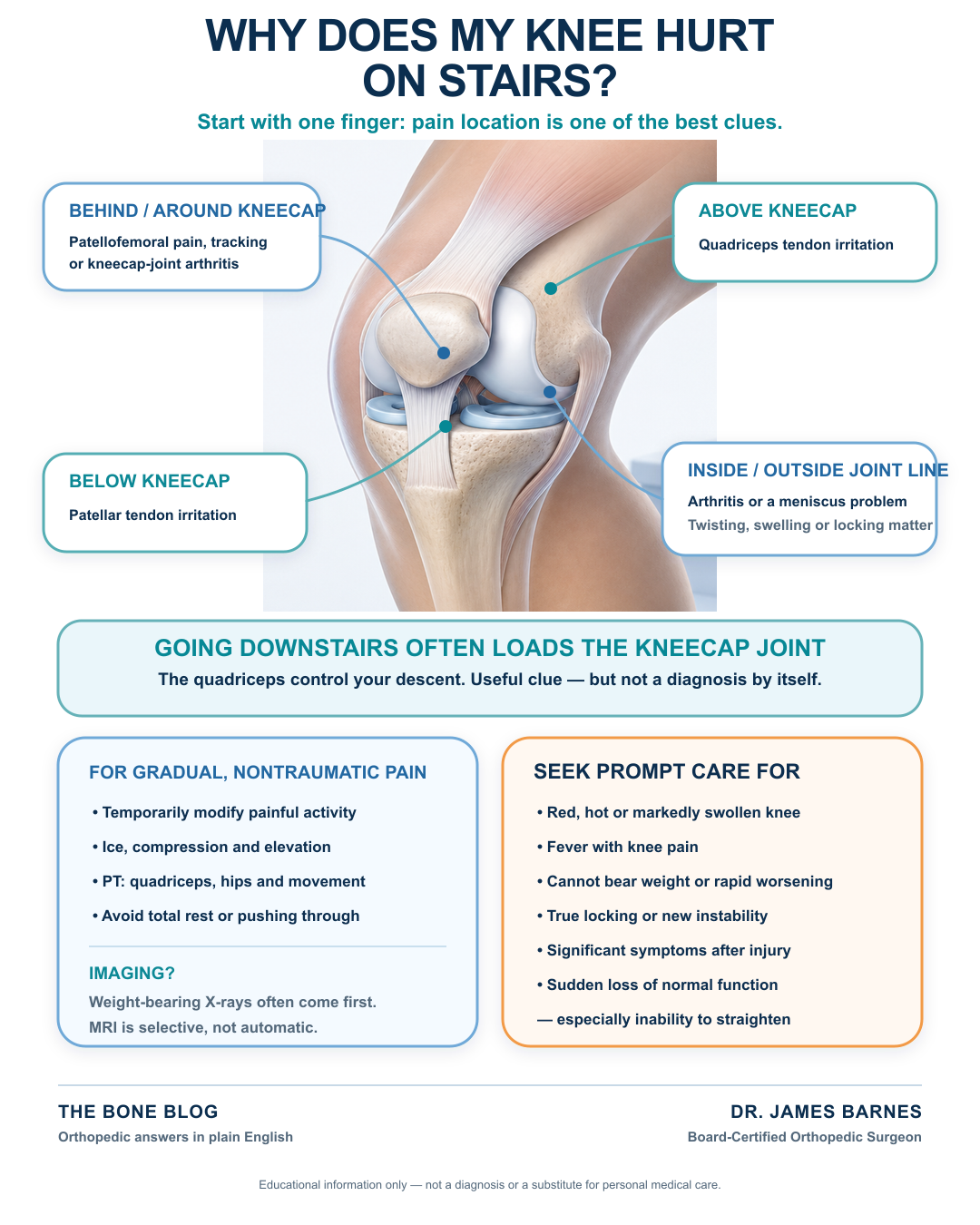 Infographic explaining common causes of knee pain on stairs by pain location, how going up and down load the knee differently, and warning signs that need evaluation.