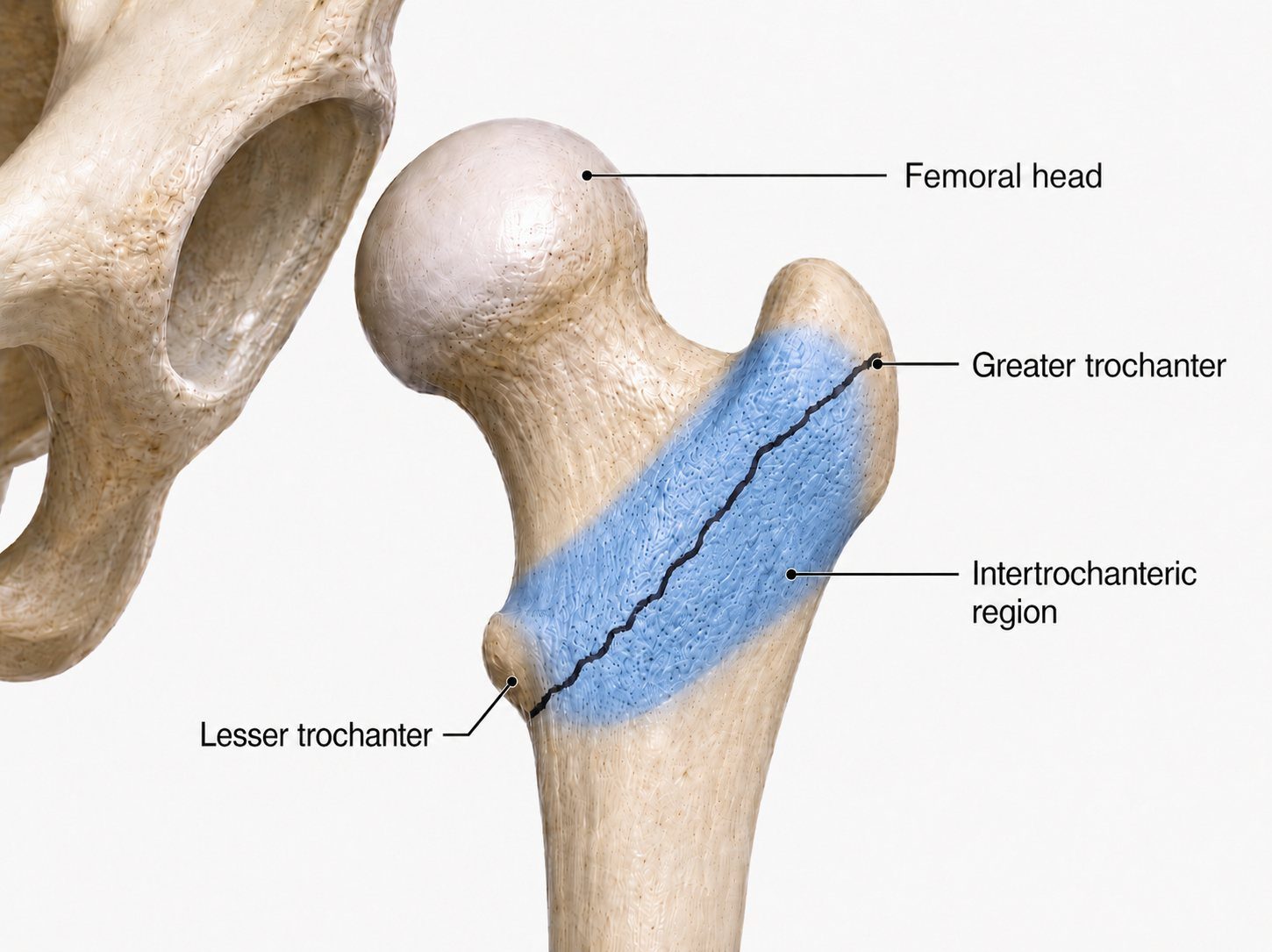 Intertrochanteric region anatomy