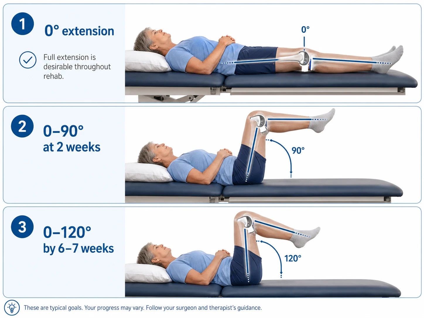 Knee replacement range-of-motion milestone graphic showing 0 degrees extension, 90 degrees at 2 weeks, and 120 degrees by 6 to 7 weeks